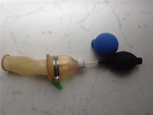 mājās gatavots dzimumlocekļa paplašināšanai