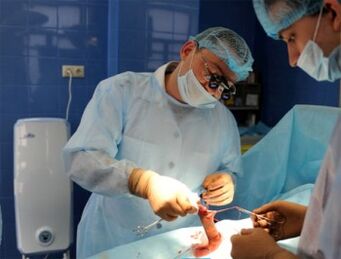 Dzimumlocekļa palielināšanas operācija, ko veic ķirurgi
